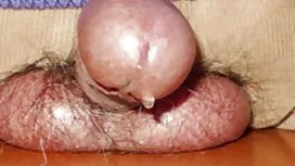 Pigtailed tuổi teen  ...